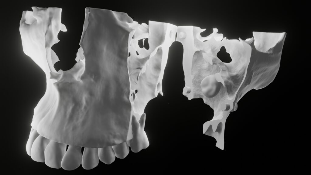 diagnostic 3d model