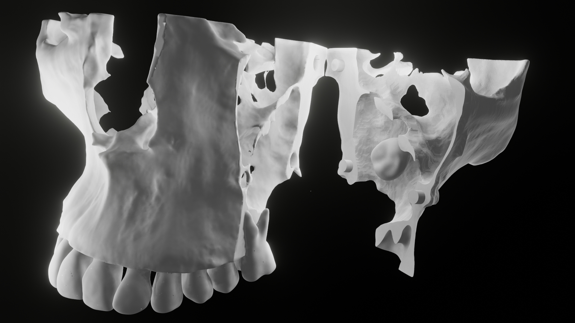 diagnostic 3d model