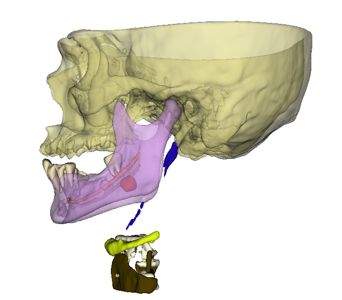 elongated styloid process