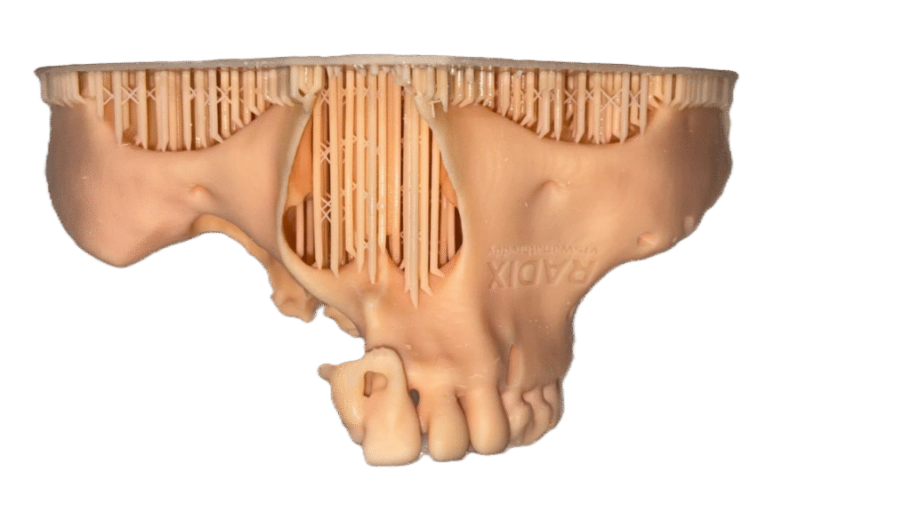 3d print of maxilla