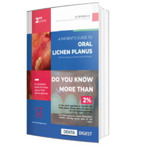 Oral Lichen planus book